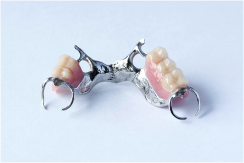 aansporing Honger zeemijl Wat is een partiële-(gedeeltelijke) prothese/frame? | Tandprothetische  Praktijk Brugman
